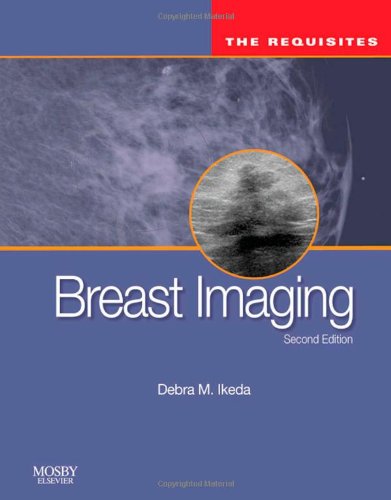 Breast Imaging The Requisites 2nd Edition 2nd Edition Debra Ikeda Md