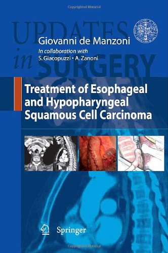 Treatment Of Esophageal And Hypopharyngeal Squamous Cell Carcinoma 1st Edition Giuseppe Verlato