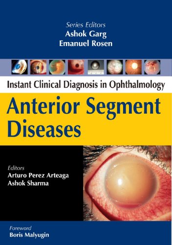Anterior Segment Diseases Instant Clinical Diagnosis In Ophthalmology 1st Edition Arturo Perez Arteaga