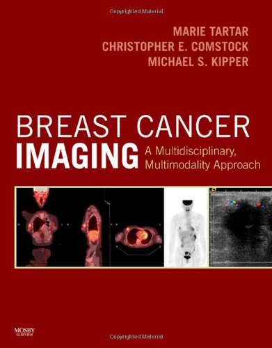 Breast Cancer Imaging A Multidisciplinary Multimodality Approach 1st Edition Marie Tartar Md