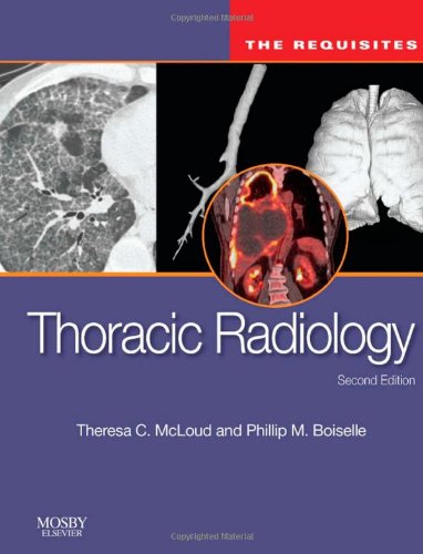 Thoracic Radiology The Requisites Second Edition Second Edition Theresa C Mcloud Md