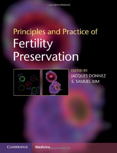 Principles And Practice Of Fertility Preservation 1st Edition Jacques Donnez Md Phd