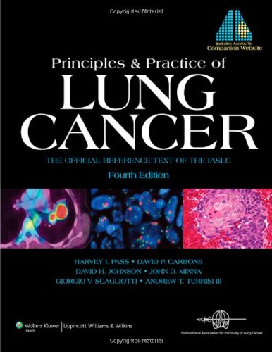Principles And Practice Of Lung Cancer The Official Reference Text Of The Iaslc 4th Edition 4th Edition Harvey I Pass