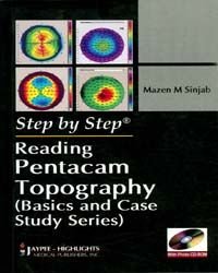 Reading Pentacam Topography Step By Step Basics And Case Study Series First Edition Mazen M Sinjab
