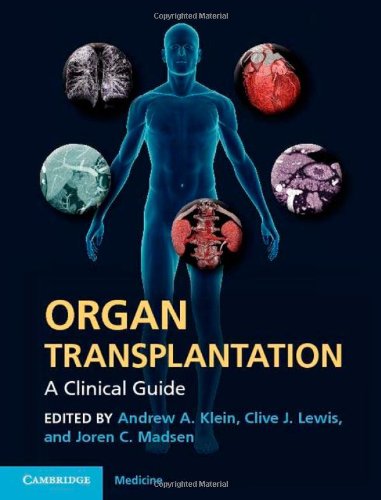 Organ Transplantation A Clinical Guide 1st Edition Andrew A Klein