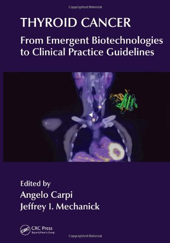 Thyroid Cancer From Emergent Biotechnologies To Clinical Practice Guidelines 1st Edition Angelo Carpi