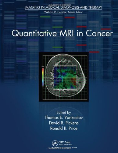 Quantitative Mri In Cancer 1st Edition Thomas Yankeelov Ronald R Price