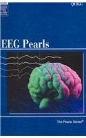 Eeg Pearls 1st Edition Mark Quigg Md Msc