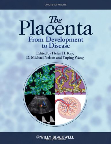 The Placenta From Development To Disease First Edition Helen Kay