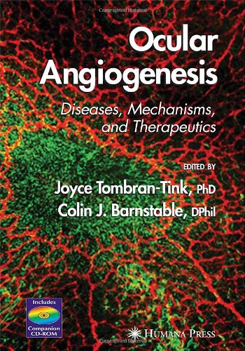 Ocular Angiogenesis Diseases Mechanisms And Therapeutics 1st Edition Joyce Tombrantink