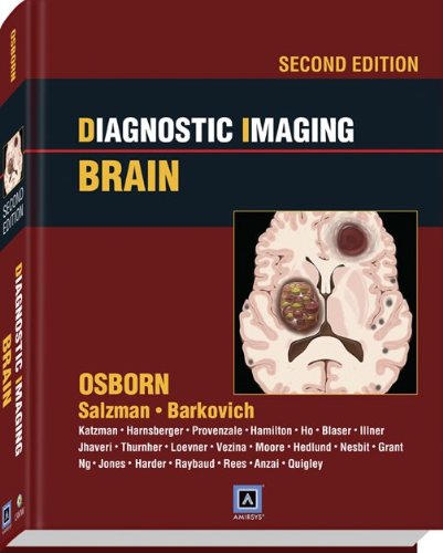 Diagnostic Imaging Brain 2nd Edition Anne G Osborn Karen L Salzman