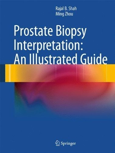 Prostate Biopsy Interpretation An Illustrated Guide 1st Edition Rajal B Shah