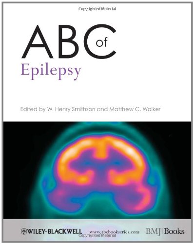 Abc Of Epilepsy 1st Edition Henry Smithson Matthew Walker