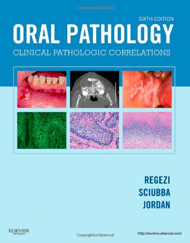 Oral Pathology Clinical Pathologic Correlations 6th Edition 6th Edition Joseph A Regezi