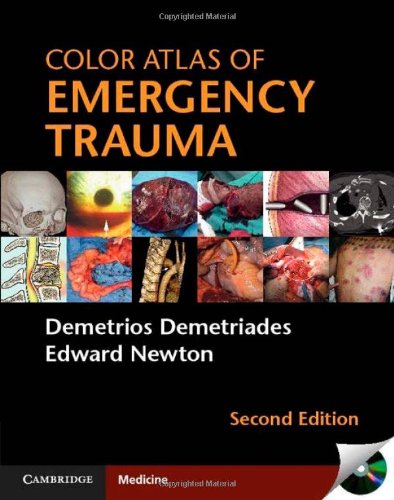Color Atlas Of Emergency Trauma 2nd Demetrios Demetriades Edward Newton
