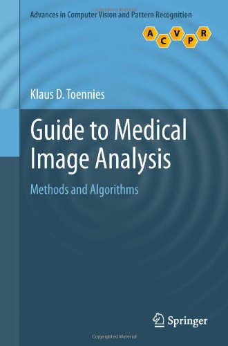 Guide To Medical Image Analysis Methods And Algorithms 1st Edition Klaus D Toennies Auth
