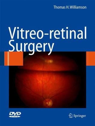 Vitreoretinal Surgery 2008th Edition Thomas H Williamson