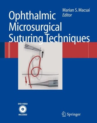 Ophthalmic Microsurgical Suturing Techniques 2007th Edition Marian S Macsai