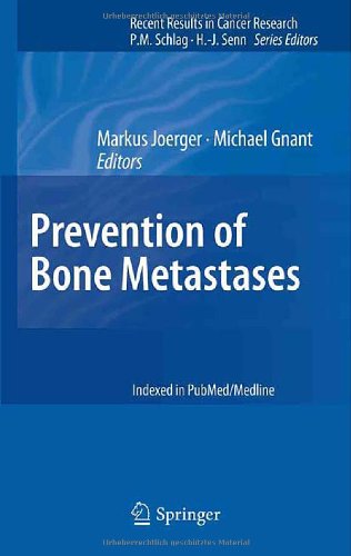 Prevention Of Bone Metastases 1st Edition Geertje Van Der Horst