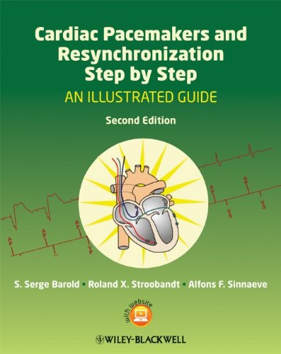 Cardiac Pacemakers And Resynchronization Step By Step An Illustrated Guide 2nd Edition S Serge Barold