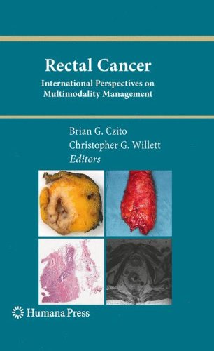 Rectal Cancer International Perspectives On Multimodality Management 1st Edition Hueylan Chern Md