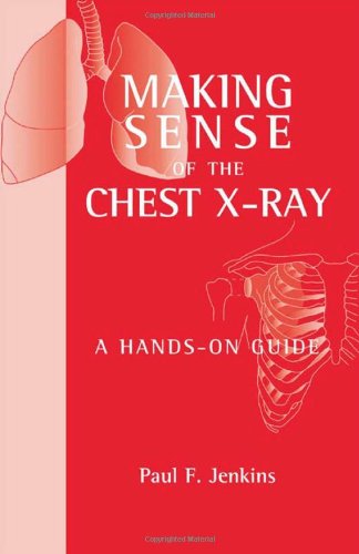 Making Sense Of The Chest Xray A Handson Guide Hodder Arnold Publication 1st Edition Paul F Jenkins