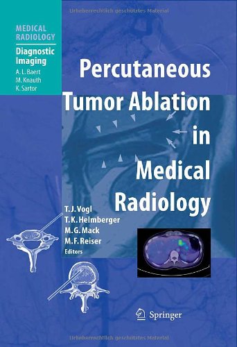 Percutaneous Tumor Ablation In Medical Radiology Medical Radiology Diagnostic Imaging 1st Edition Thomas J Vogl