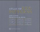 An Atlas Of Eeg Patterns 1st Edition John M Stern Jerome Engel Jr