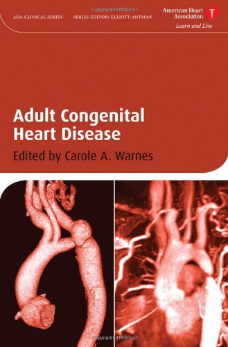 Adult Congenital Heart Disease American Heart Association Clinical Series 1st Edition Carole A Warnes