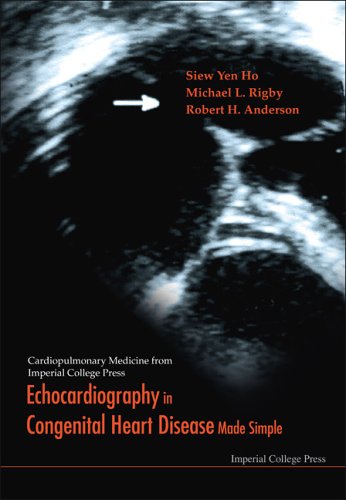 Echocardiography In Congenital Heart Disease Made Simple Cardiopulmonary Medicine From Imperial College Press 1st Edition Siew Yen Ho