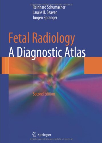 Fetal Radiology A Diagnostic Atlas 2nd Edition Professor Dr Med Reinhard Schumacher