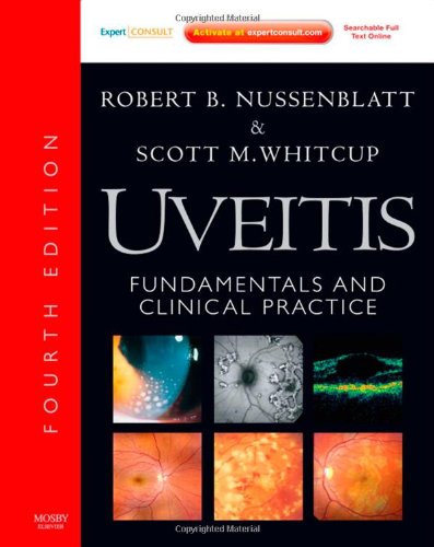 Uveitis Fundamentals And Clinical Practice Expert Consult Online And Print Fourth Edition Fourth Edition Robert B Nussenblatt Md