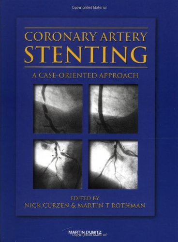 Coronary Artery Stenting A Caseoriented Approach 1st Edition Nick Curzen