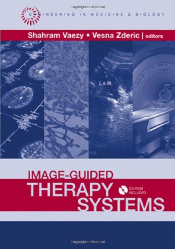 Imageguided Therapy Systems Engineering In Medicine Biology Shahram Vaezy