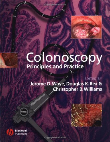 Colonoscopy Principles And Practice 1st Ed 1st Edition Jerome D Waye