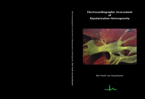 Electrocardiographic Assessment Of Repolarization Heterogeneity First Bart Hooft Van Huysduynen