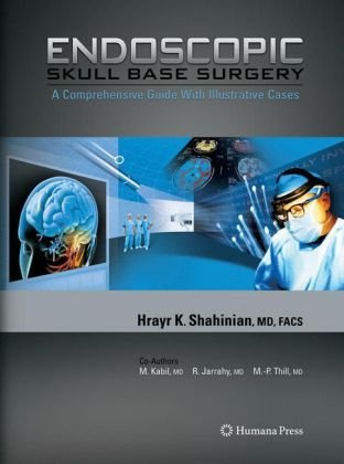 Endoscopic Skull Base Surgery A Comprehensive Guide With Illustrative Cases 1st Edition Hrayr K Shahinian Auth