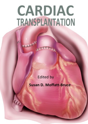 Cardiac Transplantation Susan D Moffattbruce