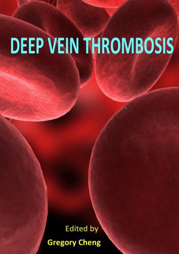 Deep Vein Thrombosis Gregory Cheng