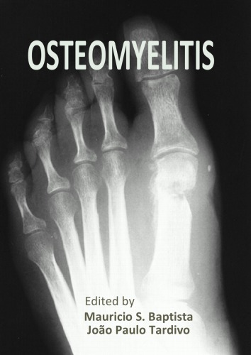 Osteomyelitis Mauricio S Baptista And Joo Paulo Tardivo
