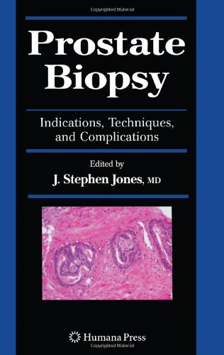 Prostate Biopsy Indications Techniques And Complications 1st Edition Wael Sakr Md Auth
