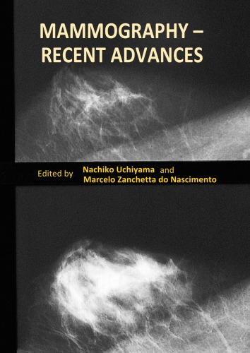 Mammography Recent Advances Nachiko Uchiyama And Marcelo Zanchetta Do Nascimento