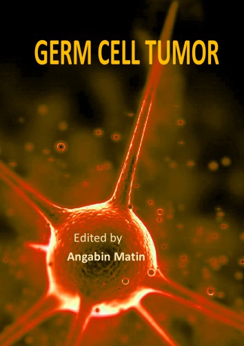 Germ Cell Tumor Angabin Matin