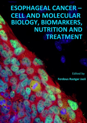 Esophageal Cancer Cell And Molecular Biology Biomarkers Nutrition And Treatment Ferdous Rastgar Jazii