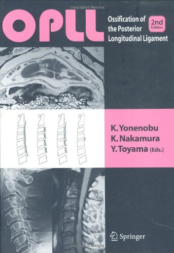 Opll Ossification Of The Posterior Longitudinal Ligament 2nd K Yonenobu