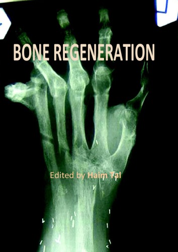 Bone Regeneration Haim Tal