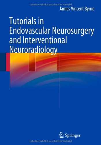 Tutorials In Endovascular Neurosurgery And Interventional Neuroradiology 1st Edition James Vincent Byrne Auth