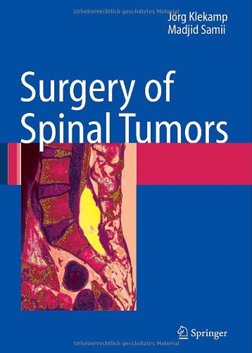 Surgery Of Spinal Tumors 1st Edition Jrg Klekamp Madjid Samii