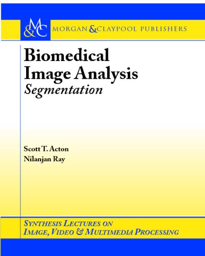 Biomedical Image Analysis Segmentation 1st Edition Nilanjan Ray