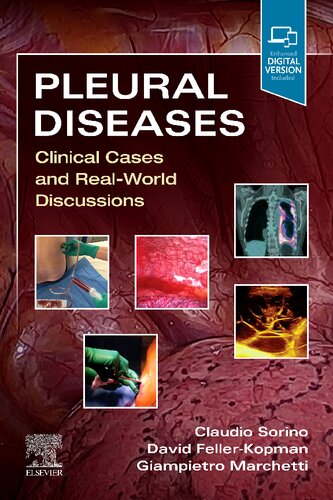 Pleural Diseases Clinical Cases And Realworld Discussions 1st Edition Claudio Sorino